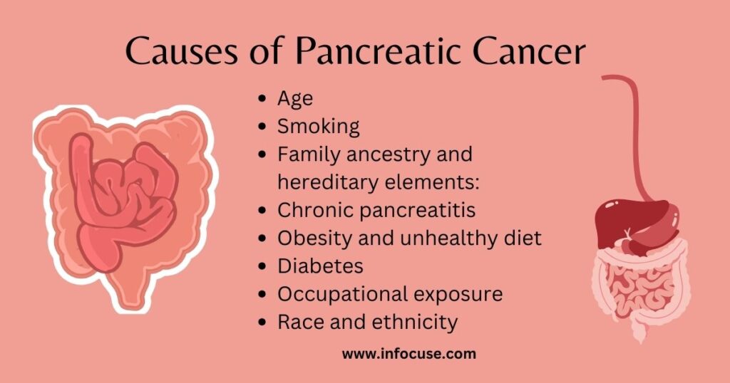 Causes of Pancreatic cancer