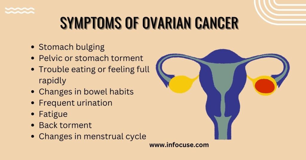 ovarian cancer symptoms